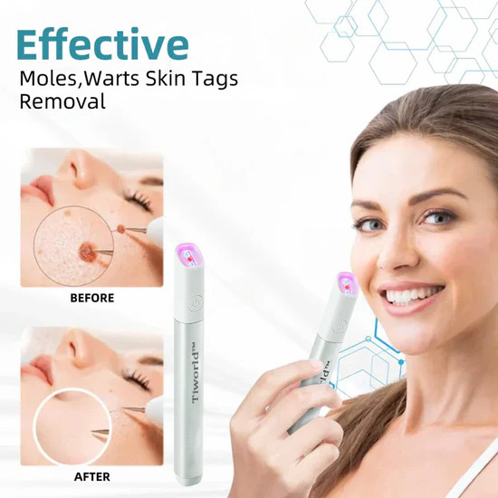 Tiworld™ All-in-One Laser Eraser Pen(Powered by CO₂ laser technology – effectively removes moles, warts, skin tags, pigmentation spots, and other skin imperfections)