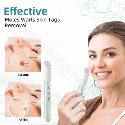 Tiworld™ All-in-One Laser Eraser Pen(Powered by CO₂ laser technology – effectively removes moles, warts, skin tags, pigmentation spots, and other skin imperfections)