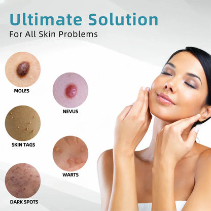 Tiworld™ All-in-One Laser Eraser Pen(Powered by CO₂ laser technology – effectively removes moles, warts, skin tags, pigmentation spots, and other skin imperfections)