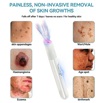 Tiworld™ All-in-One Laser Eraser Pen(Powered by CO₂ laser technology – effectively removes moles, warts, skin tags, pigmentation spots, and other skin imperfections)
